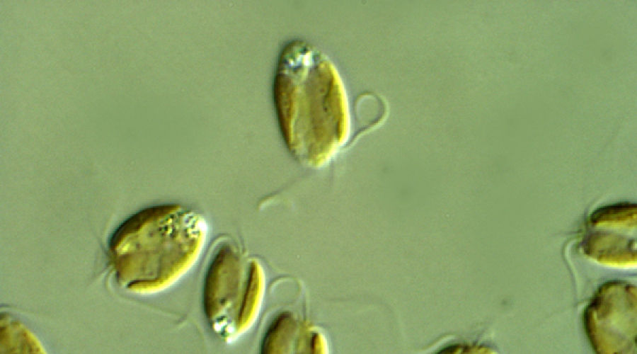 Представитель Семейства Prymnesiaceae